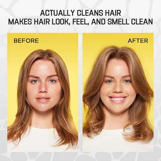 2025 Hot Sale 49% OFF🔥Invisible Hair Dry Shampoo