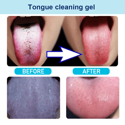 Probiotic Tongue Cleaning Gel Set(Buy 3 Get Free Shipping)