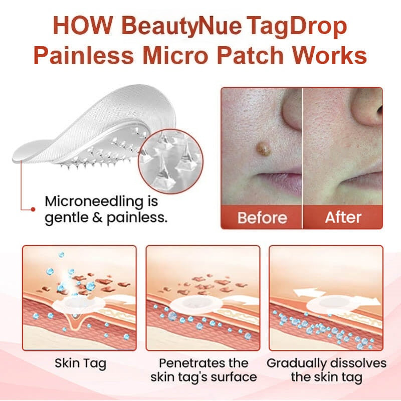 đ„painless micro-patchđ„