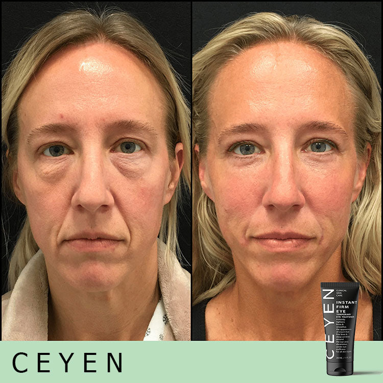 Hot Sale 49% OFF🔥Temporary Eye Cream - The Most Effective Solution To Get Rid Of Eye Bags