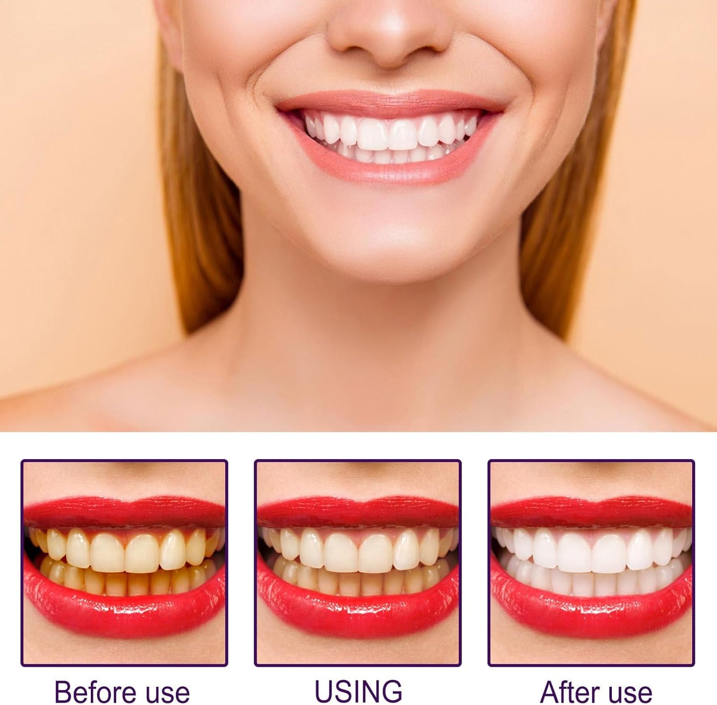 BUY 1 GET 1 FREE!🦷 Oral Care Teeth Whitener Pen✨