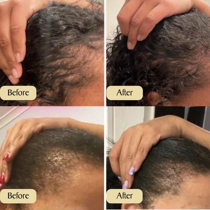 Hot Sale 49% OFF--Natural Hair Growth Oil