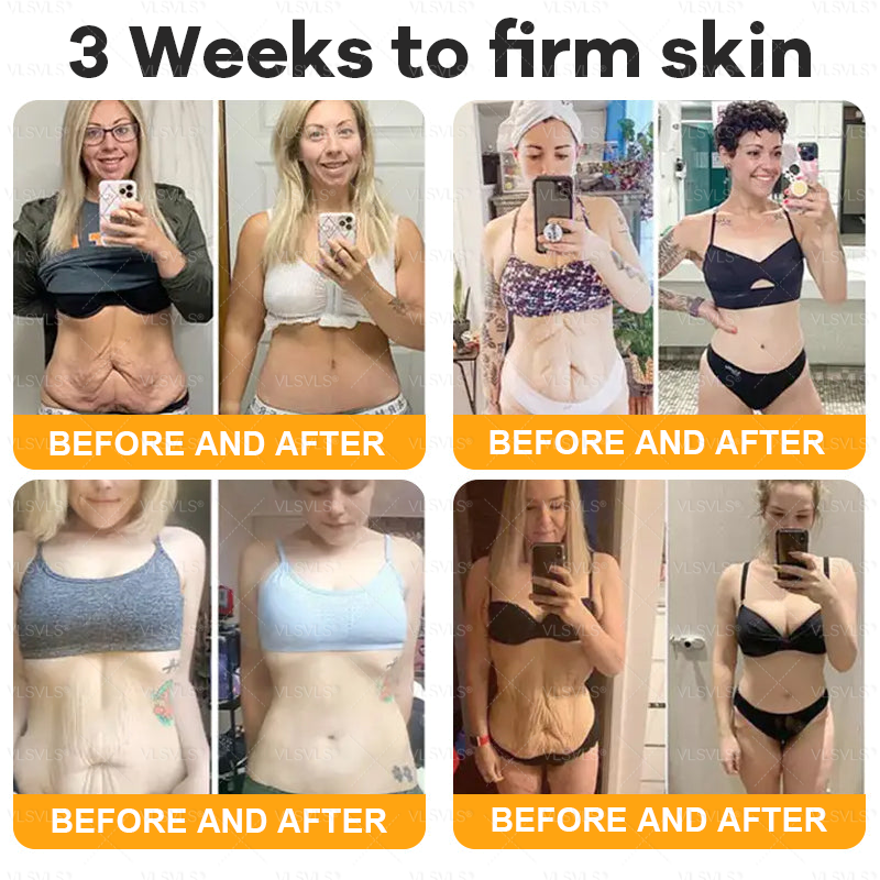 🔥 LAST DAY 49 % OFF✨ VLSVLS® Bee Venom Skin Restoration Cream