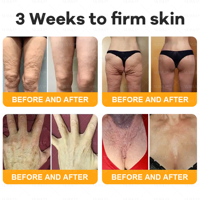 🔥 LAST DAY 49 % OFF✨ VLSVLS® Bee Venom Skin Restoration Cream