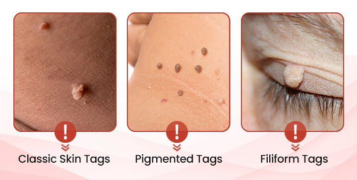 đ„painless micro-patchđ„