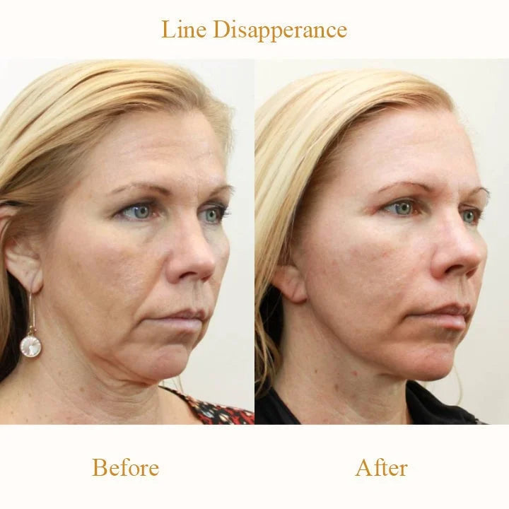Buy 2 Get 1 FreešPlumping Anti-Wrinkle Patches