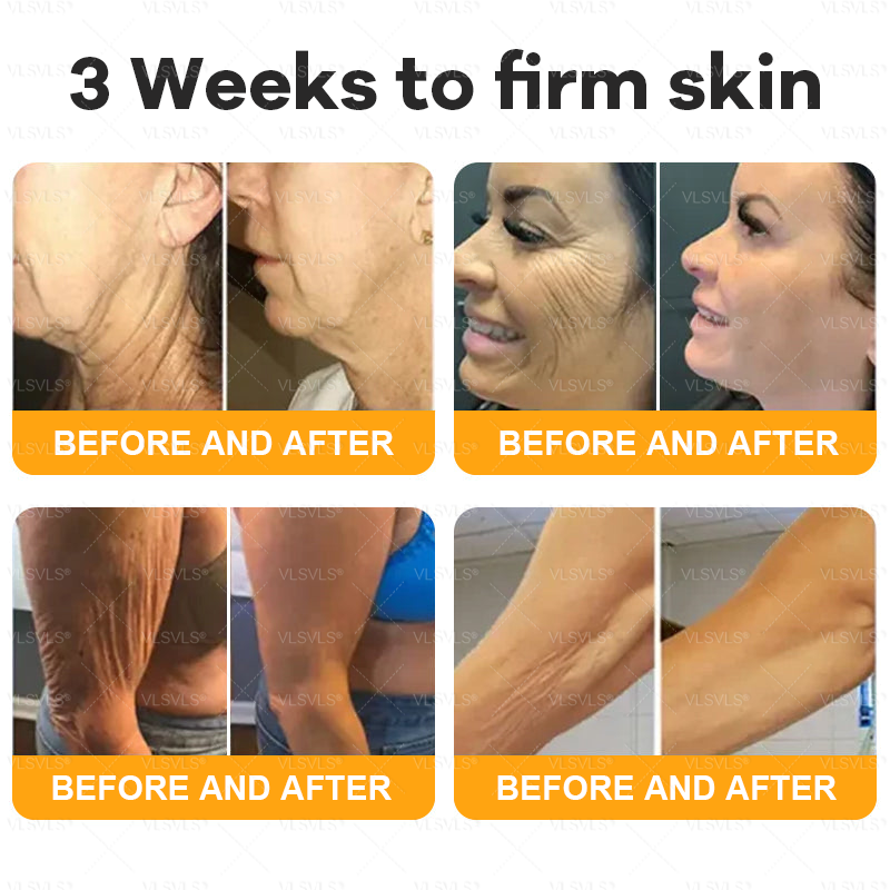 🔥 LAST DAY 49 % OFF✨ VLSVLS® Bee Venom Skin Restoration Cream