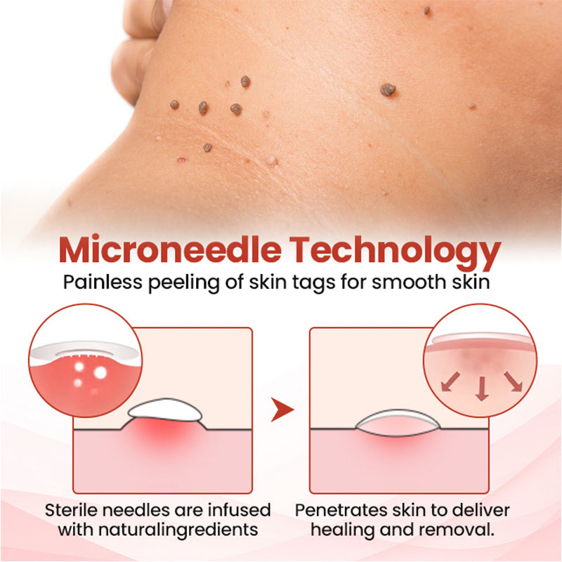 đ„painless micro-patchđ„