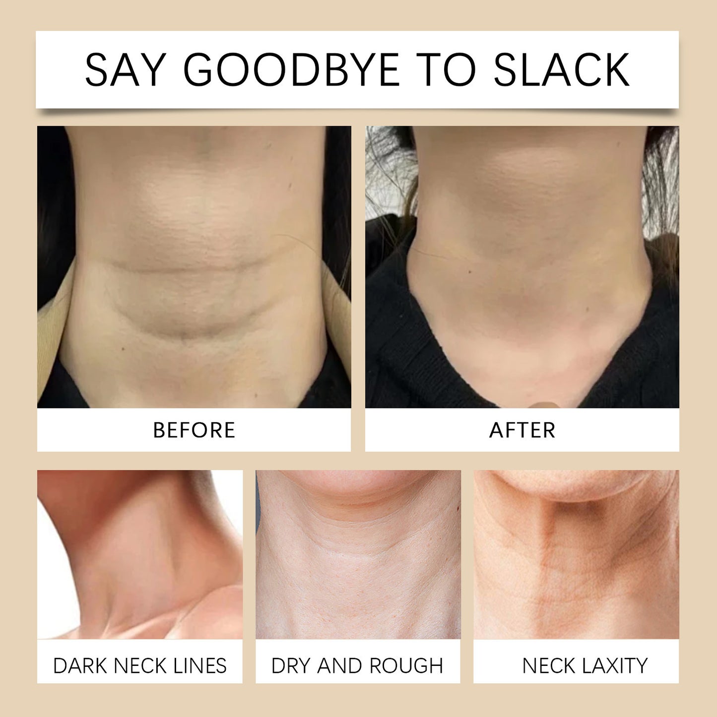 Hot Sale 49% OFF - Neck Firming Cream
