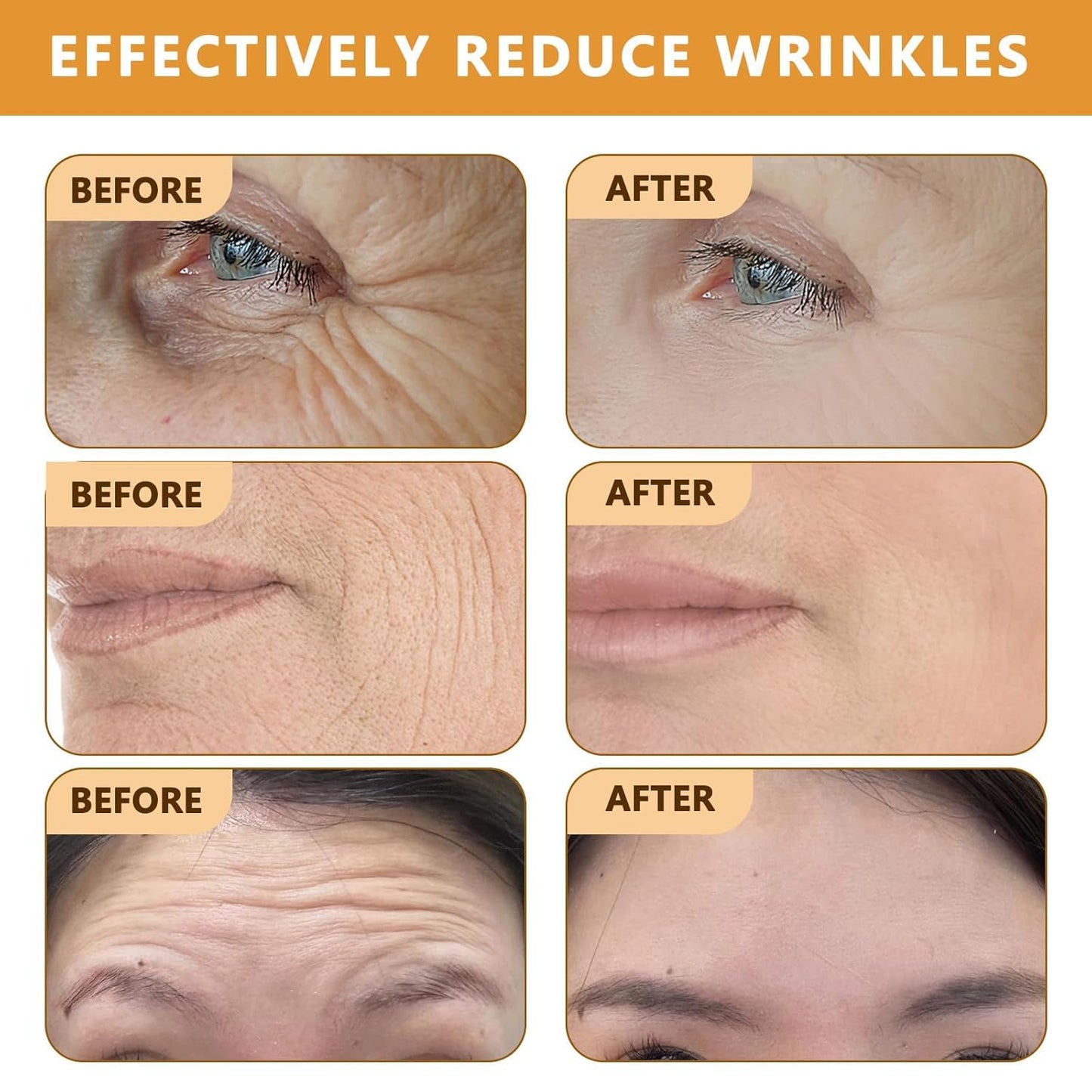 🔥2025 HOT SALE-49% OFF🔥👨⚕️Botox Bee Venom Wrinkle Removal Cream