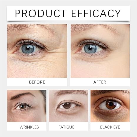 β¨π§ Eye Serum Oil β Limited Time 49% OFF π₯ Reveal Timeless Radiance