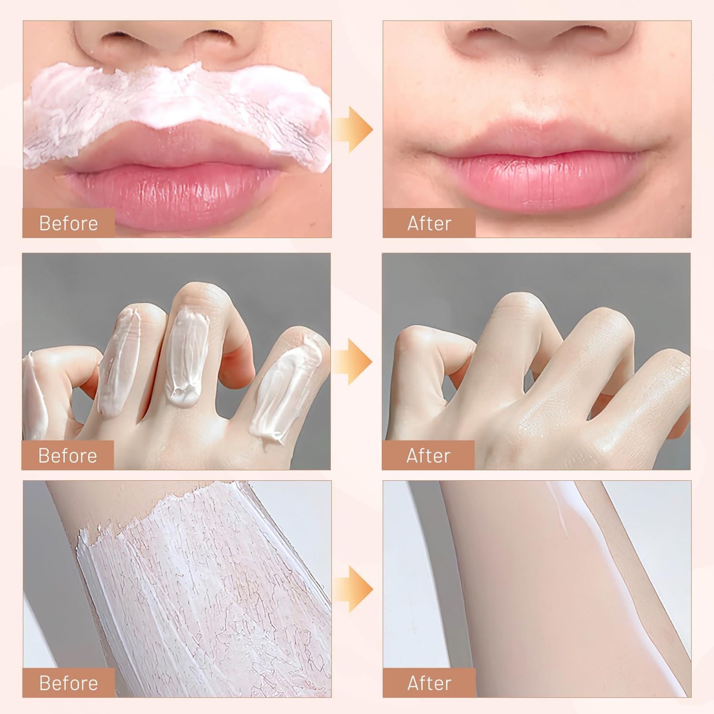 HOT SALE 49% off🔥Gentle and Painless Hair Removal Kit