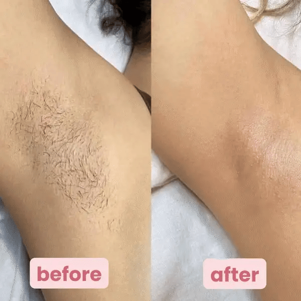 Summer Sale 49%off🔥2025 New Arrivals Premier Shaver