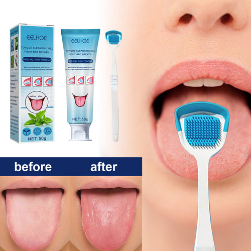 Probiotic Tongue Cleaning Gel Set(Buy 3 Get Free Shipping)