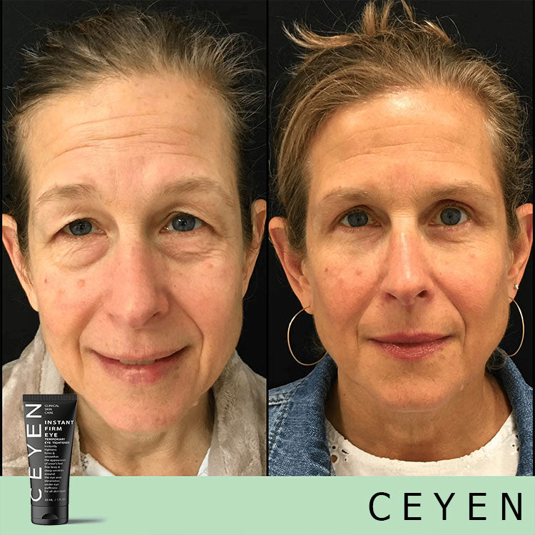 Hot Sale 49% OFF🔥Temporary Eye Cream - The Most Effective Solution To Get Rid Of Eye Bags