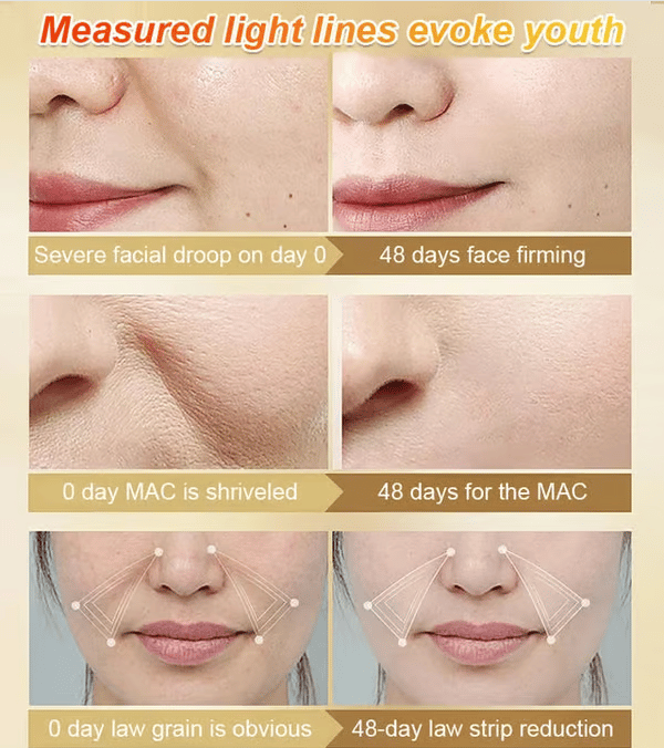 💎 Refined Care ✨ Anti-Wrinkle Serum – 49% OFF ⏰ Unlock Your Radiance