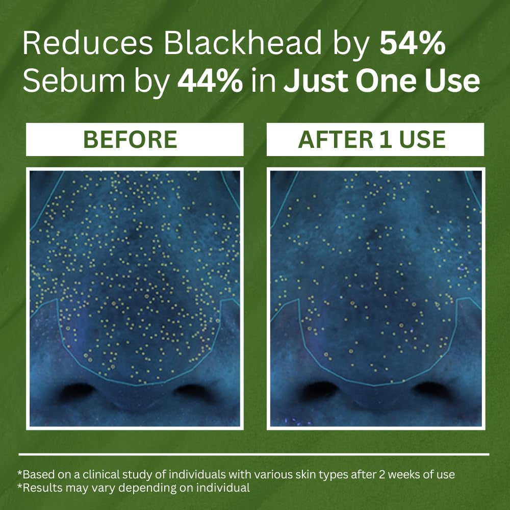 Buy 1 Get 1 Free 49%off Holy Basil Bubble Deep Mask