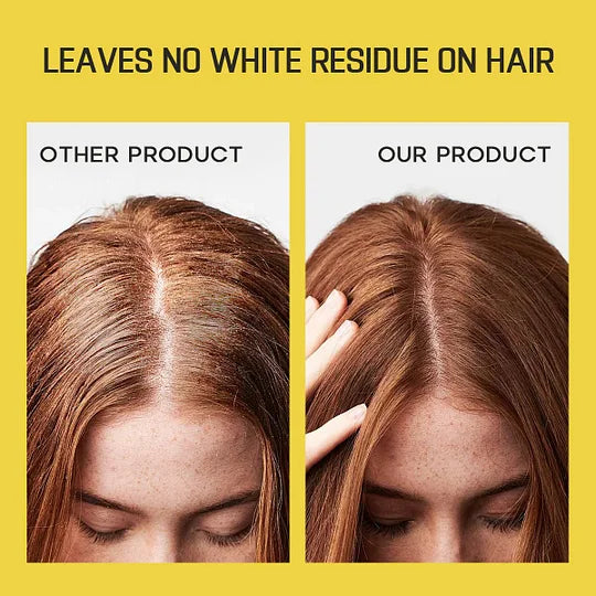 2025 Hot Sale 49% OFF🔥Invisible Hair Dry Shampoo