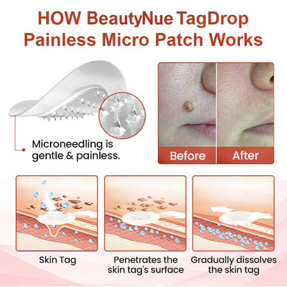 💥painless micro-patch🔥