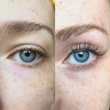 Hot Sale 49% off🔥Eyelash Active Serum For Longer & Fuller Lashes