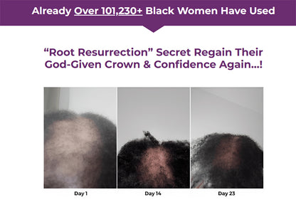 💝HOT SALE NOW 49% OFF❤️Hair Growth Serum