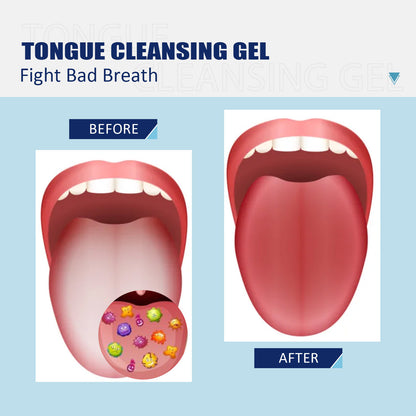 Probiotic Tongue Cleaning Gel Set(Buy 3 Get Free Shipping)