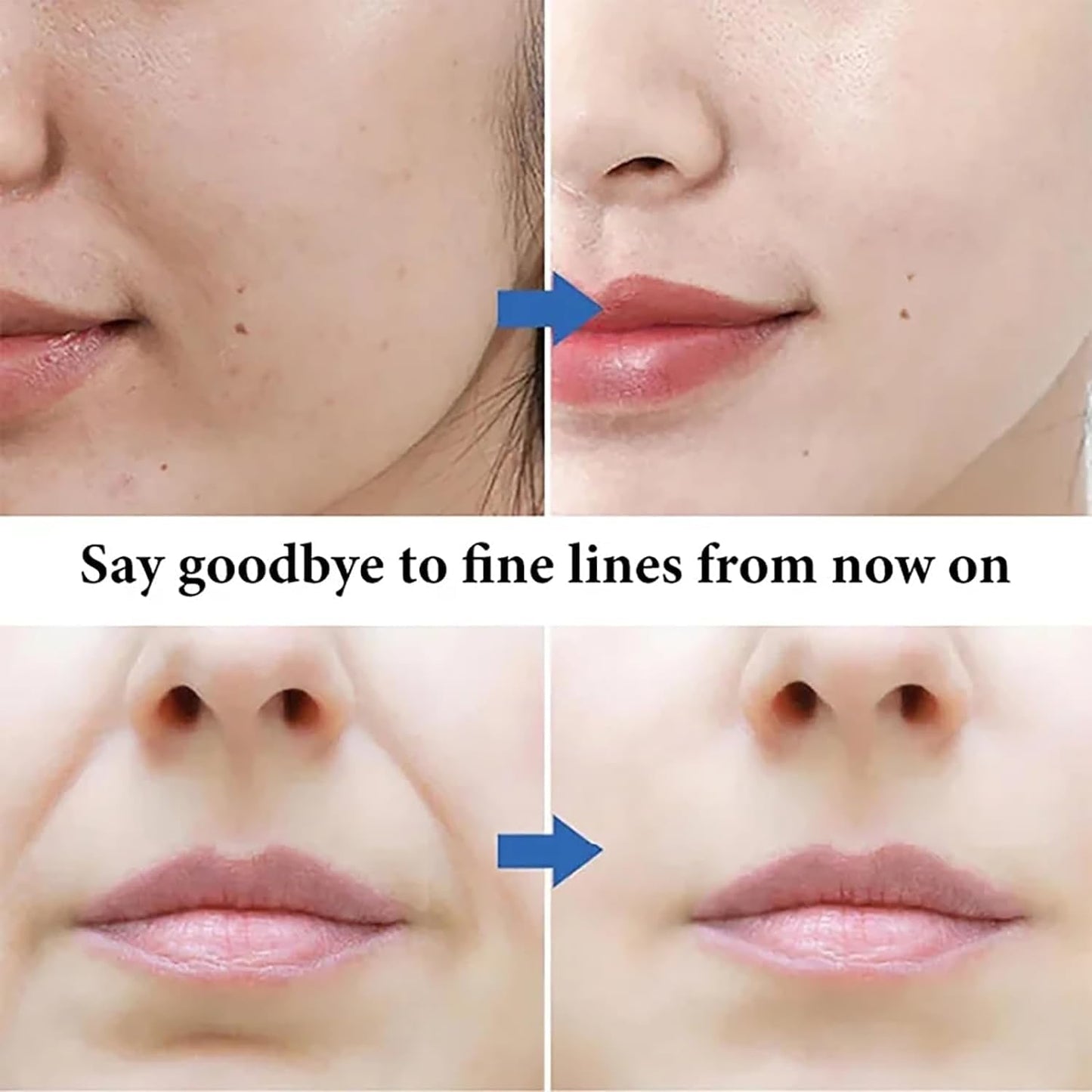 Hot sale 49%off🔥Microcrystalline Nasolabial Folds Removal Mask