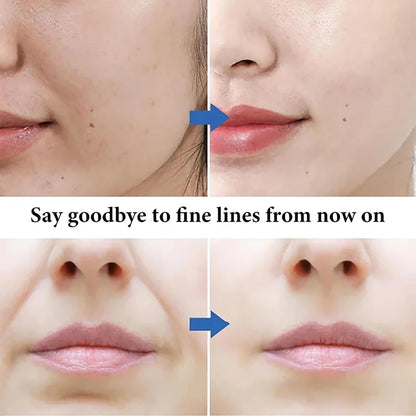 Hot sale 49%off🔥Microcrystalline Nasolabial Folds Removal Mask