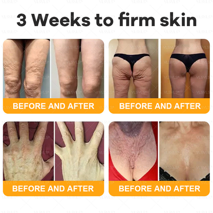 🔥 LAST DAY 49 % OFF✨ VLSVLS® Bee Venom Skin Restoration Cream
