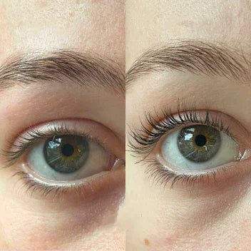 Hot Sale 49% off🔥Eyelash Active Serum For Longer & Fuller Lashes