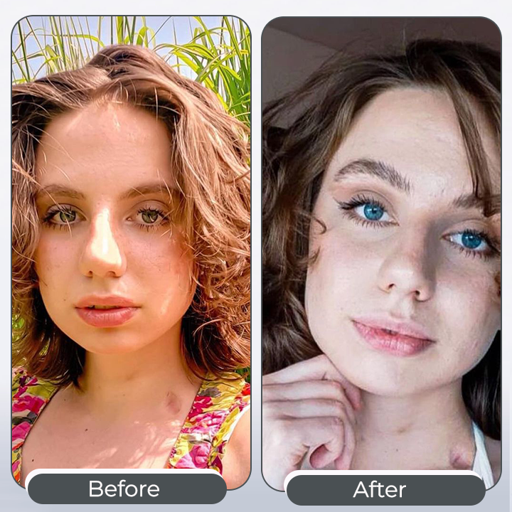 🔥HOT SALE 49% OFF🔥Miracle eye drops-that can change the color of your eyes