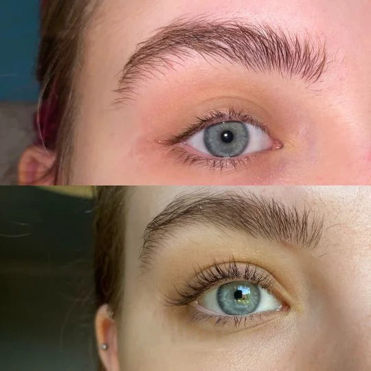 Hot Sale 49% off🔥Eyelash Active Serum For Longer & Fuller Lashes