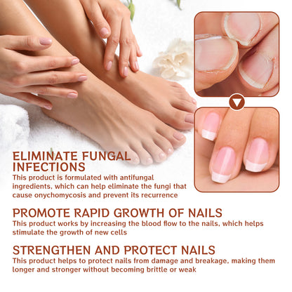 [Last Day 49% OFF] 7-day nail growth and strengthening serum