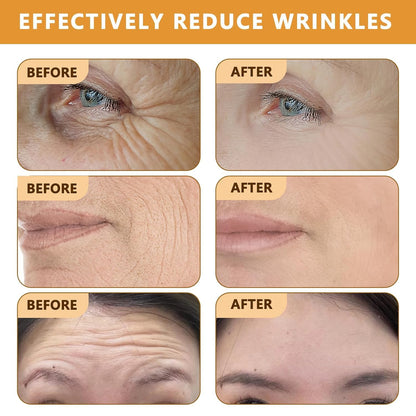 🔥2025 HOT SALE-49% OFF🔥👨‍⚕️Botox Bee Venom Wrinkle Removal Cream