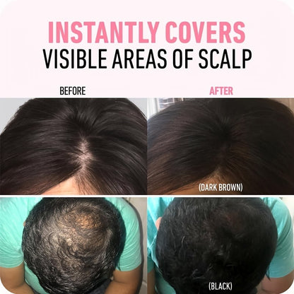 Best Sellers - Hairline Powder Instantly Conceals Hair Loss, Root Touch Up Hair Powder