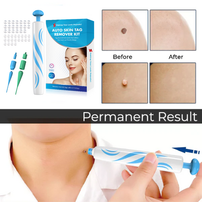 ✨ Painless Skin Tag Remover ✨ — Reveal Smooth, Clear Skin Fast! 🌿