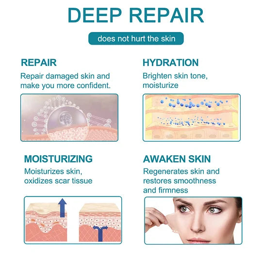 Hot sale 49%off🔥BeautyNue™ Advanced Scar Spray For All Types of Scars - For example Acne Scars, Surgical Scars and Stretch Marks