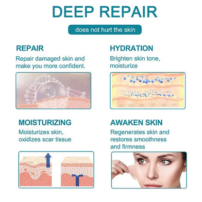 Hot sale 49%off🔥BeautyNue™ Advanced Scar Spray For All Types of Scars - For example Acne Scars, Surgical Scars and Stretch Marks