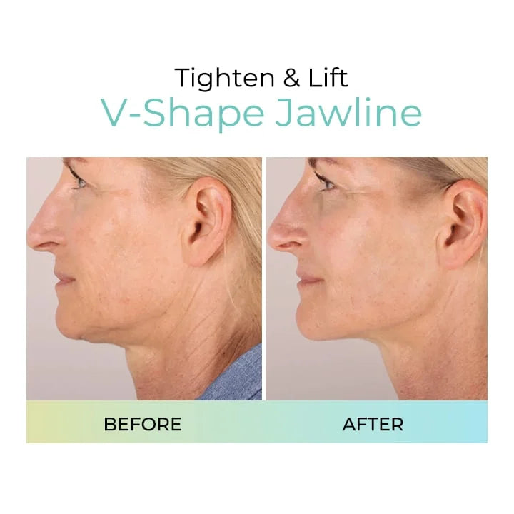Buy 2 Get 1 Free🎉Plumping Anti-Wrinkle Patches