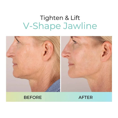 Buy 2 Get 1 Free🎉Plumping Anti-Wrinkle Patches