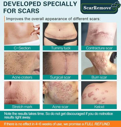 Hot sale 49%off🔥BeautyNue™ Advanced Scar Spray For All Types of Scars - For example Acne Scars, Surgical Scars and Stretch Marks