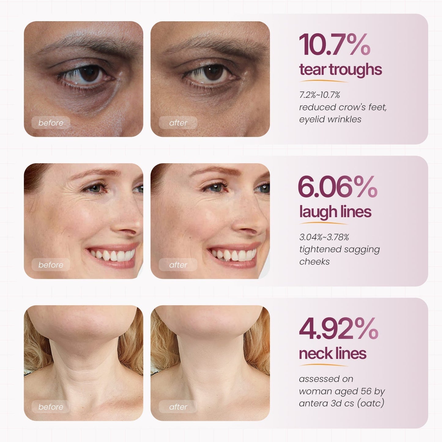 BUY 1,GET 1 FREE Cemenrete Calcium Multi Balm | Anti-aging, Sagging, Wrinkles