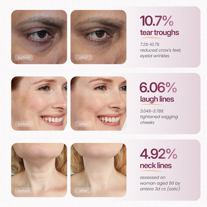 BUY 1,GET 1 FREE Cemenrete Calcium Multi Balm | Anti-aging, Sagging, Wrinkles