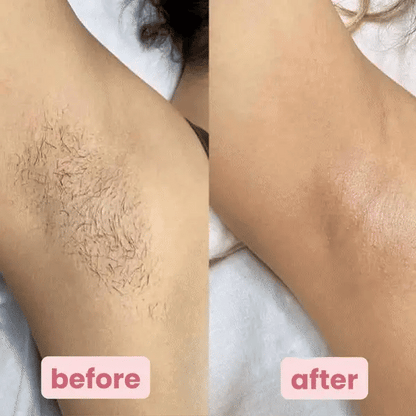 Summer Sale 49%off🔥2025 New Arrivals Premier Shaver