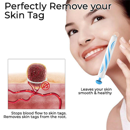 ✨ Painless Skin Tag Remover ✨ — Reveal Smooth, Clear Skin Fast! 🌿