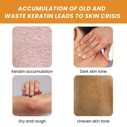 BUY MORE GET MORE FREE 49%off🔥🔥Whitening Exfoliating Gel