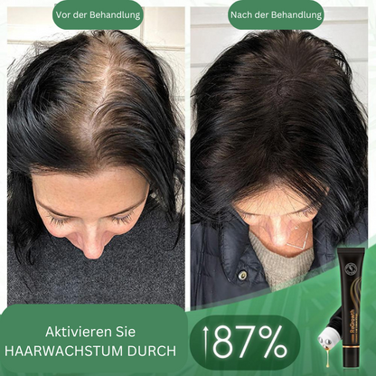 HairBoost  Bio Hair Serum Roller (Buy 1 Get 1 Free)