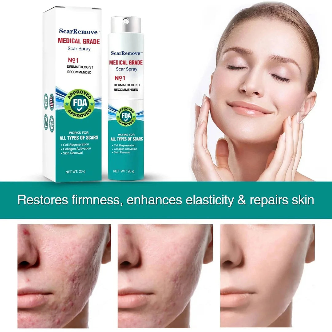 Hot sale 49%off🔥BeautyNue™ Advanced Scar Spray For All Types of Scars - For example Acne Scars, Surgical Scars and Stretch Marks