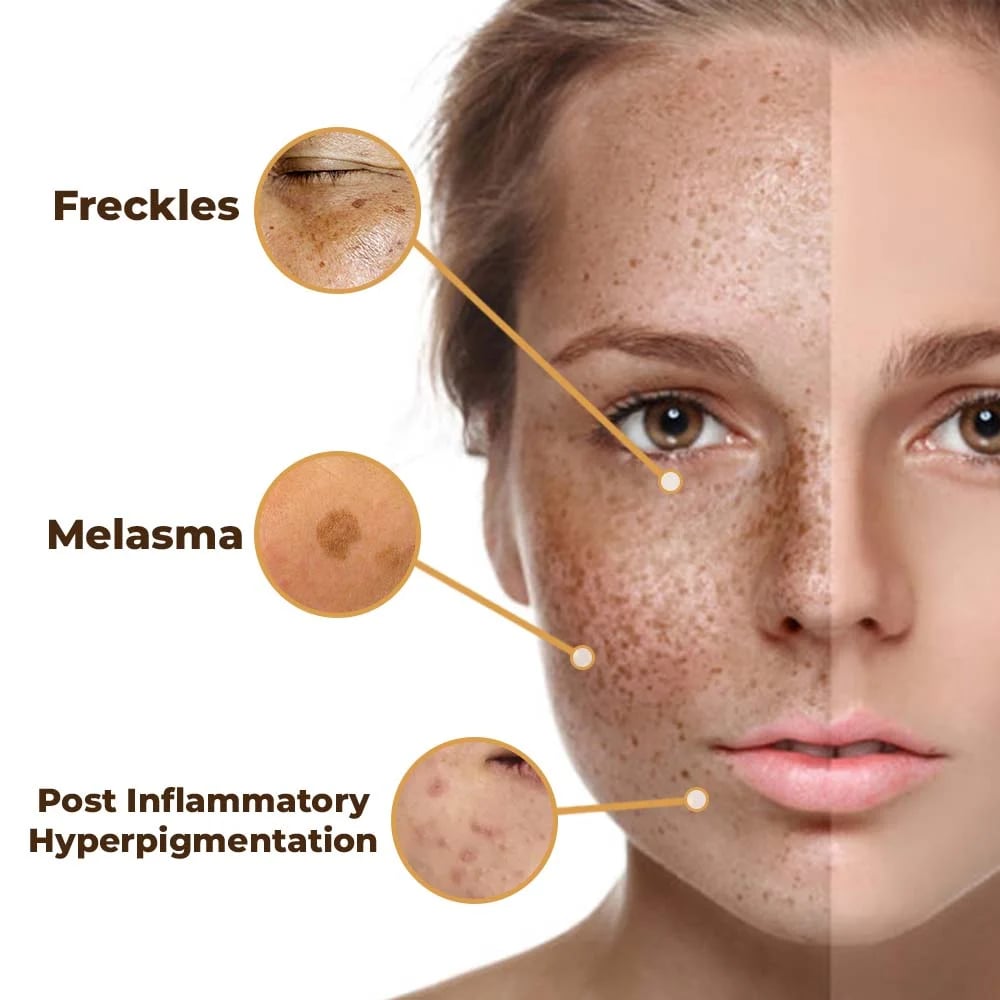 BUY 1 GET 1 FREE 49%OFF🌸2025 New Whitening Skin Melanin Correcting Facial Serum