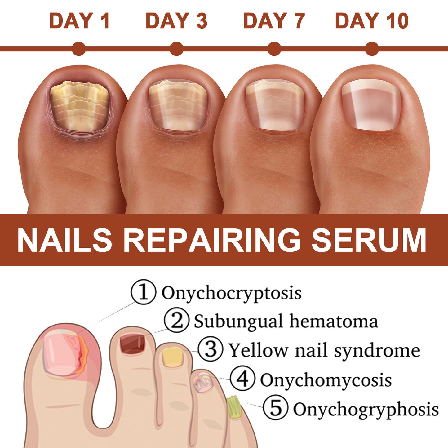 [Last Day 49% OFF] 7-day nail growth and strengthening serum